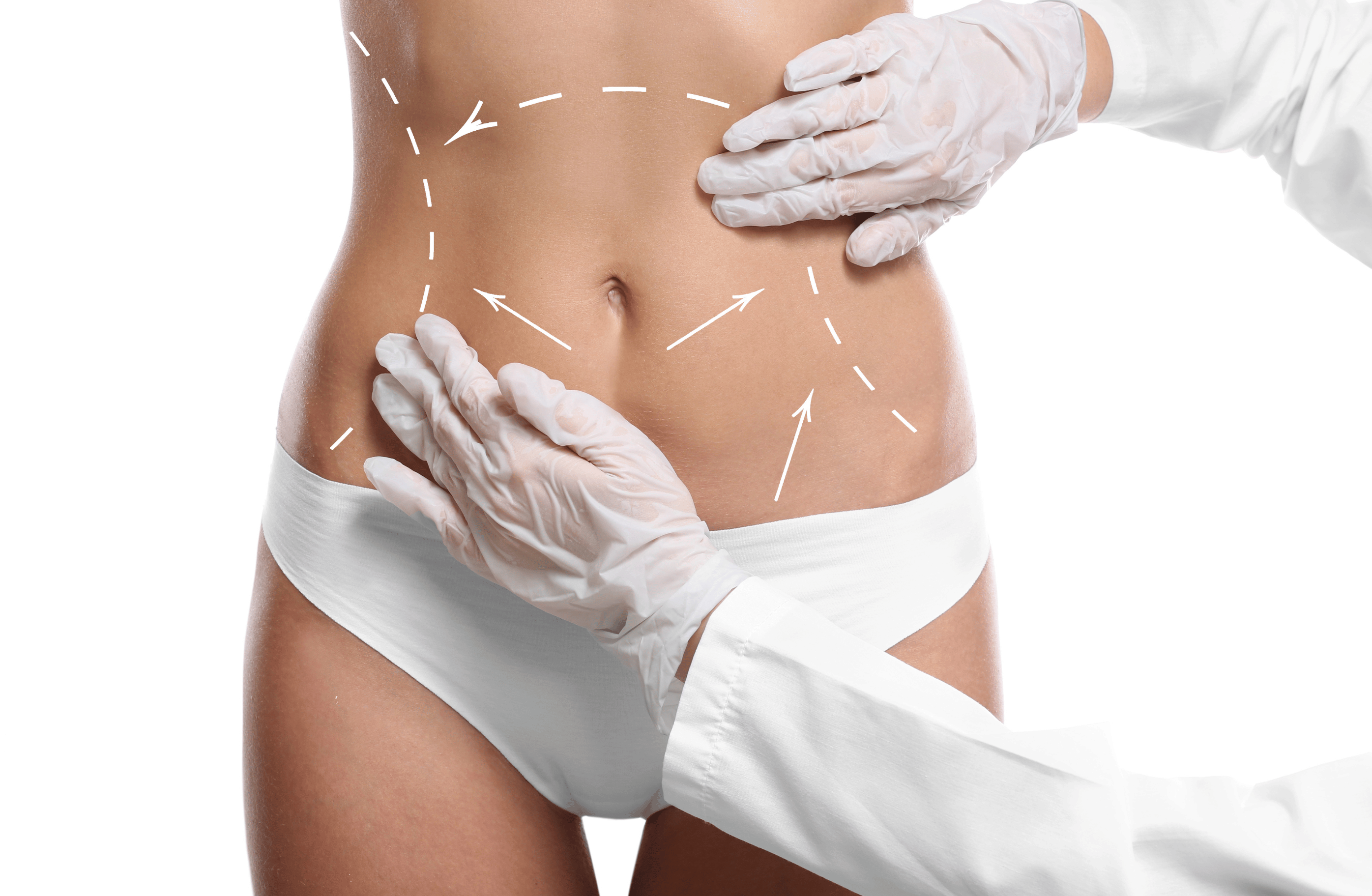 blogs-tipos-de-lipoaspiracao